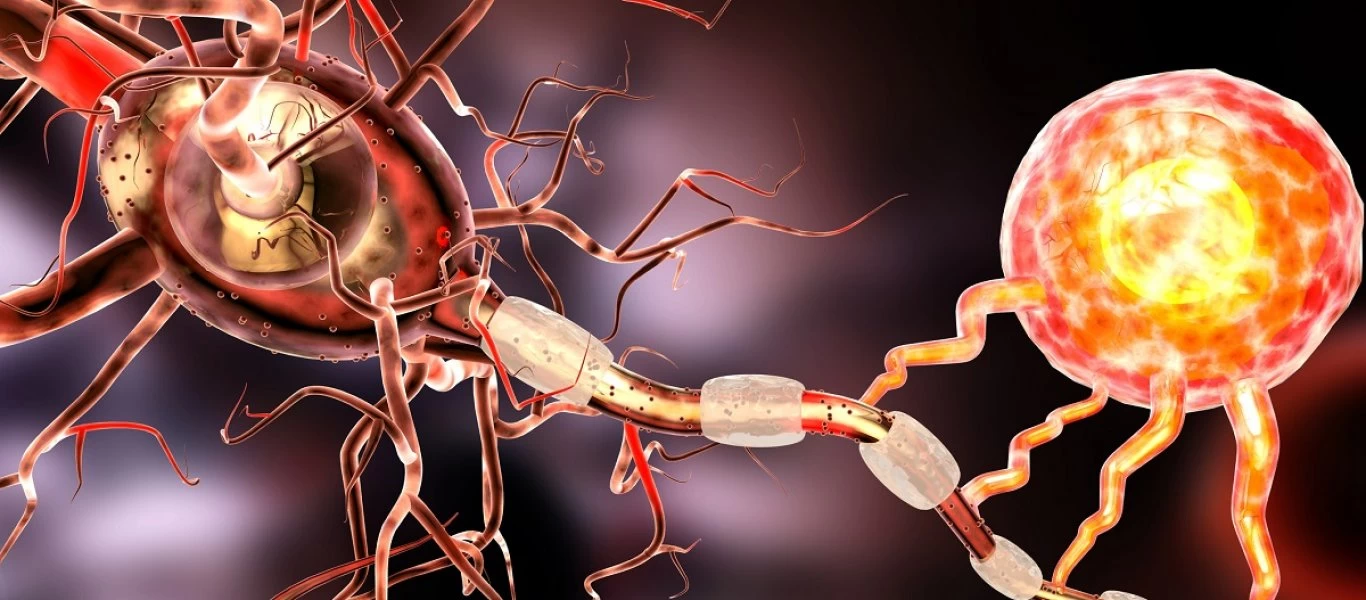 Αυτά είναι τα 13 παράδοξα συμπτώματα της σκλήρυνσης κατά πλάκας